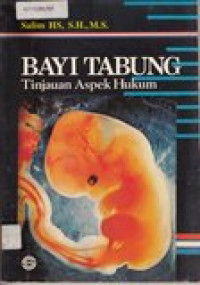 Bayi tabung: tinjauan aspek hukum