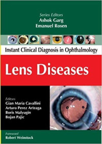 Lens disesase: Instant clinical diagnosis in ophtimology lens disesase